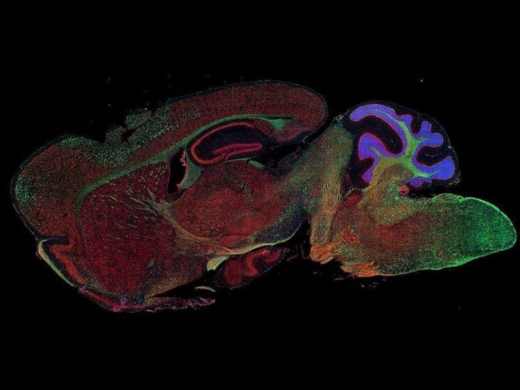 Fluorescence imaging of a mouse brain