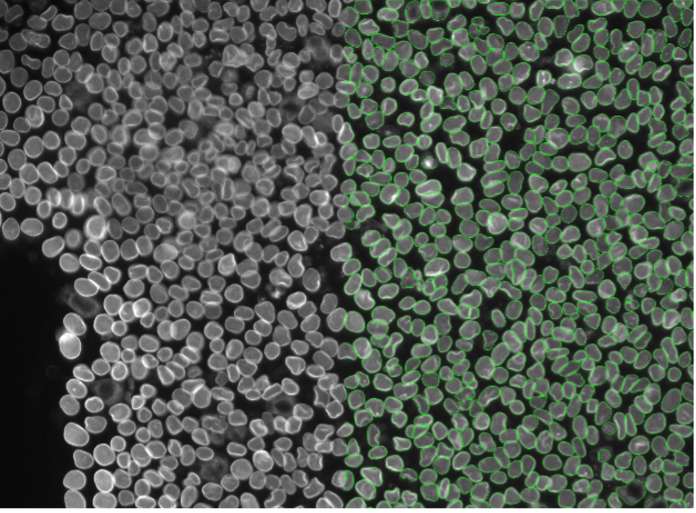 Segmentation d’images de cellules végétales par apprentissage profond