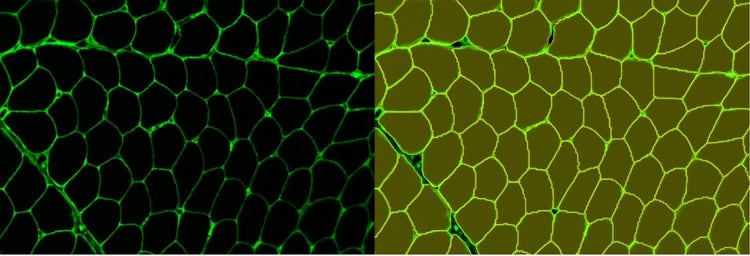 Segmentation d’instances d’une coloration de fibres musculaires