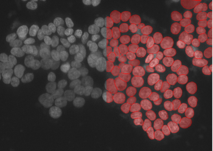 Segmentation d'images de cellules de carcinome humain A549 par apprentissage profond