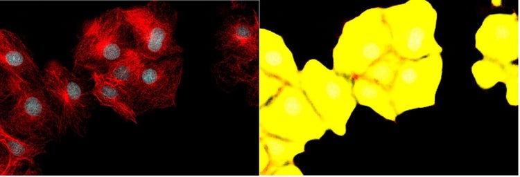 Segmentation d’images de l’actine F par apprentissage profond