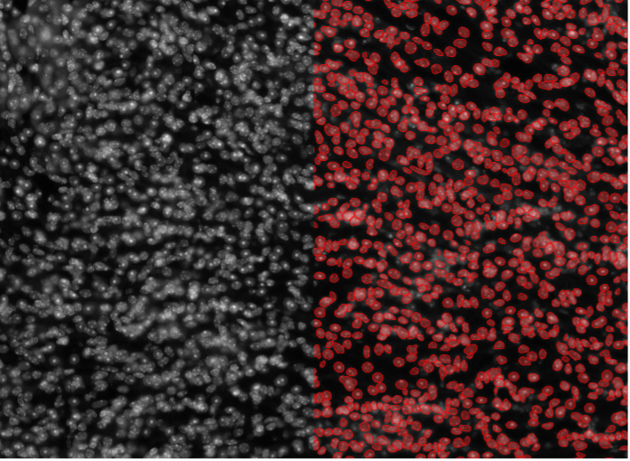 Segmentation d'images de cellules de tissus rénaux de souris par apprentissage profond