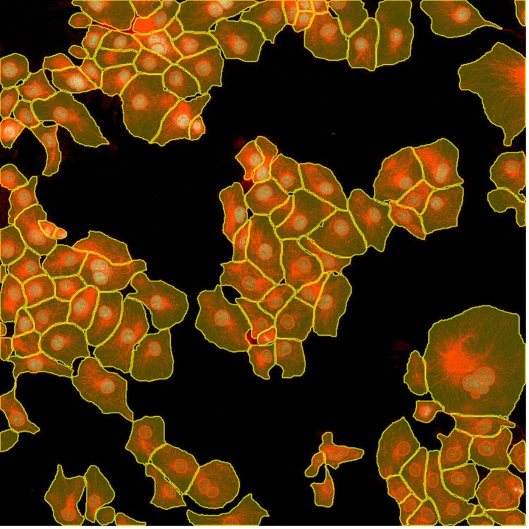 Segmentation d’instances de noyaux et de cellules à l’aide de l’apprentissage profond