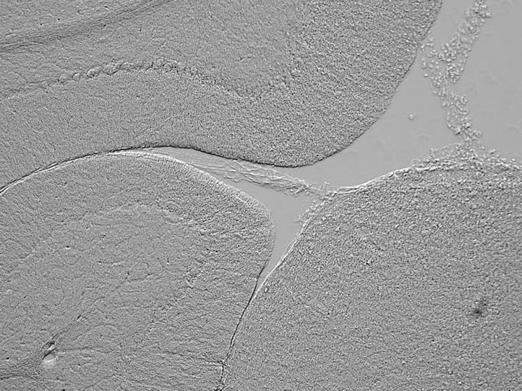 Échantillons de contraste de gradient