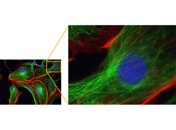 Amélioration de la planéité de l'image
