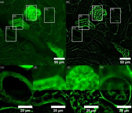 Comparaison des images d’un échantillon de rein de souris acquises par imagerie à grand champ et par imagerie SILA