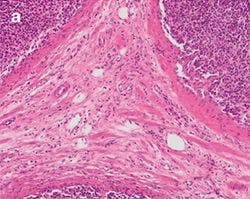 Figure 5: Stained Tissue Section a