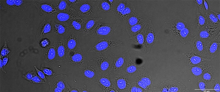 (C) AI prediction of nuclei positions from brightfield image