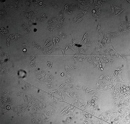 Figure 3 Detailed view showing the strong background and inhomogeneity that can occur in brightfield transmission imaging. Note the out-of-focus contributions from unwanted particles