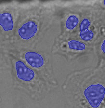 (C) TruAI detection of nuclei positions from the brightfield image