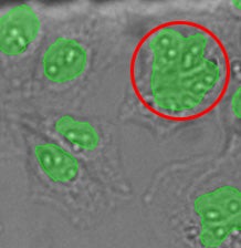 (A) GFP nuclear labels