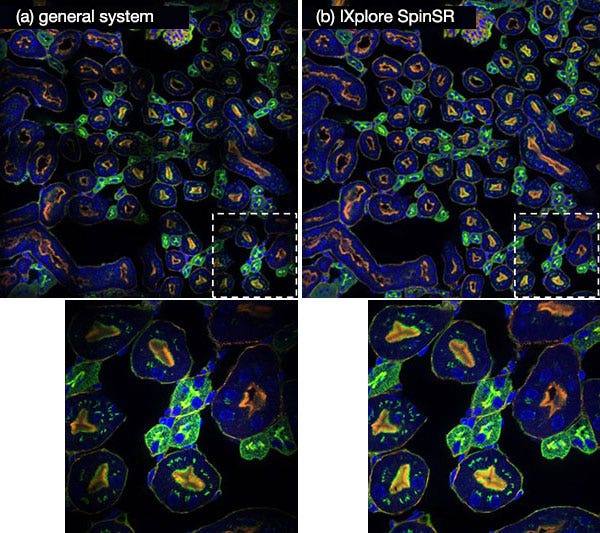 Figure 9. An image in which 25 (5 vertical × 5 horizontal) neighboring fluorescence images are stitched together acquired by systems in which the connection with the optical system for magnification is optimized (a) and unoptimized (b).