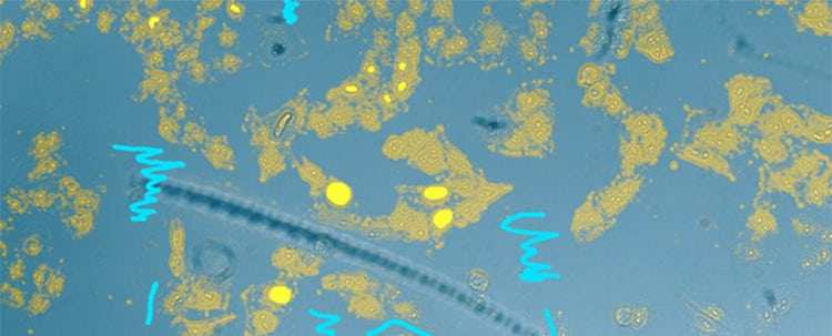 Figure 4 Nucleus detection result from transmission image by general machine learning. Trained by manually marking the nucleus yellow and the background light blue. The detection accuracy is low.