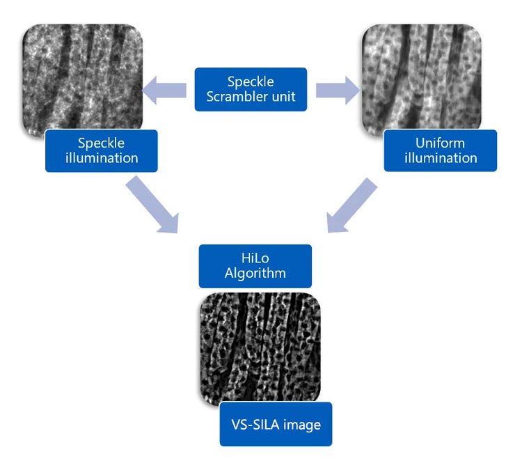 Acquisition d’une image VS-SILA pour l’imagerie de lames entières d’échantillons épais