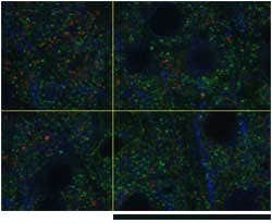 UPLASAPO60XO, Z=35μm