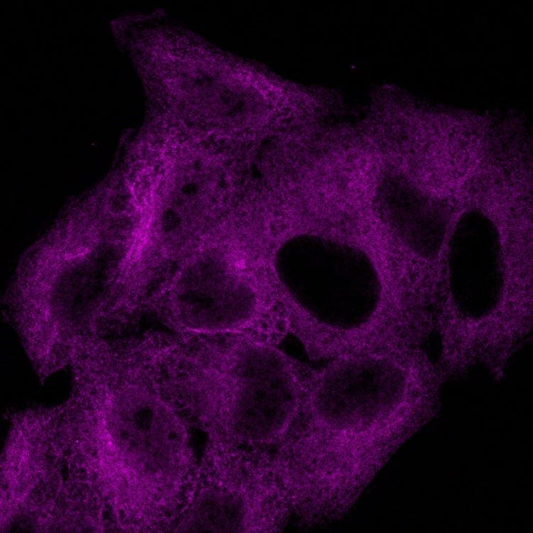 microtubule (Qdot605; magenta)