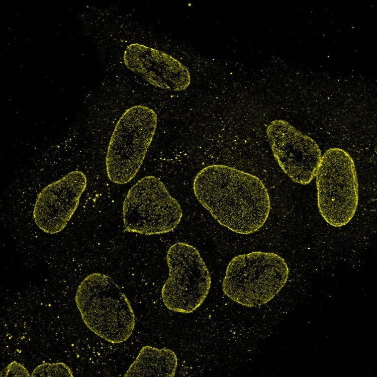 nuclear pore (AF561; yellow)