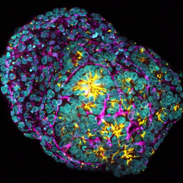 Human kidney organoid.