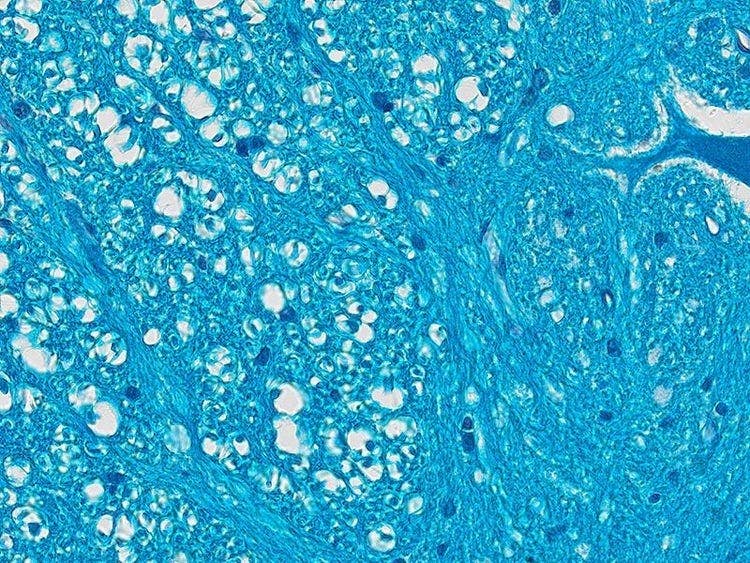Specimen: Spinal cord; Microscope: CX23, Objective: Plan Achromat 40x (NA 0.65), TV-Adaptor: U-TV0.5XC-3, Illumination: Brightfield (LED), Exposure time: 8.1 ms