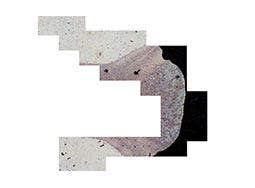 L’assemblage d’images numériques (manuel ou automatique) peut élargir le champ de vision et ainsi permettre l’analyse de grandes zones d’intérêt.