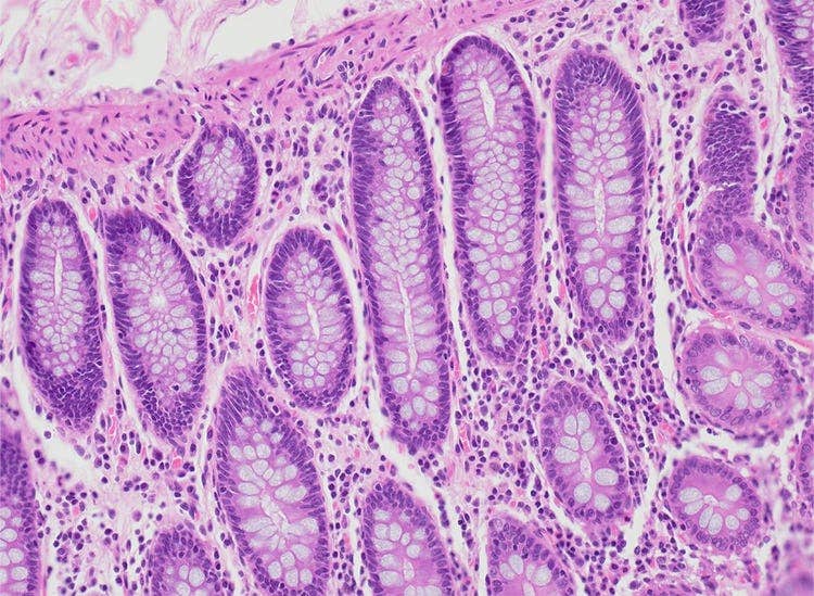 Côlon. Coloration : HE