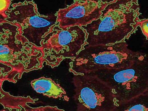 Image screenshot detail following data acquisition by scanR demonstrating the detection and separation of labels. Courtesy of Dr. R. Pepperkok, EMBL Heidelberg, Germany.