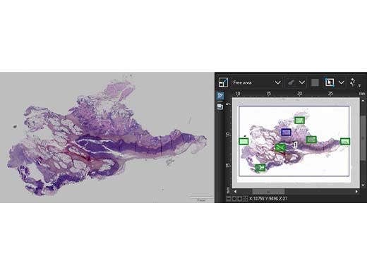 Correction automatique des échantillons inégaux