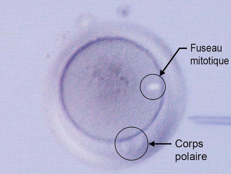 Fuseau mitotique / Corps polaire