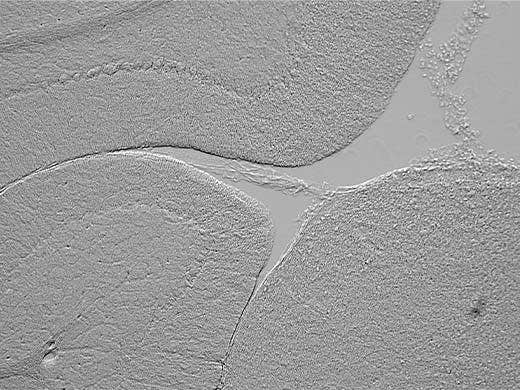 Cerveau de rat acquis par contraste de gradient