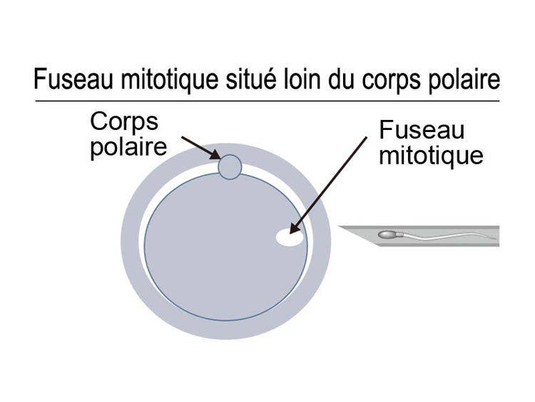 Fuseau mitotique situé loin du corps polaire