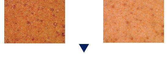 Different operators use different settings