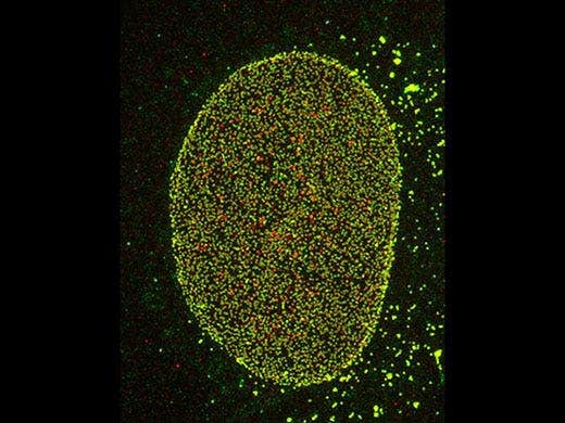 Complexe de pores nucléaires d’une cellule Hela