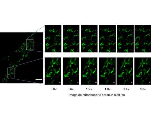 Mitochondrie étiquetée par GFP. Images acquises à 30 ips; permet d’observer les mouvements individuels de la mitochondrie.