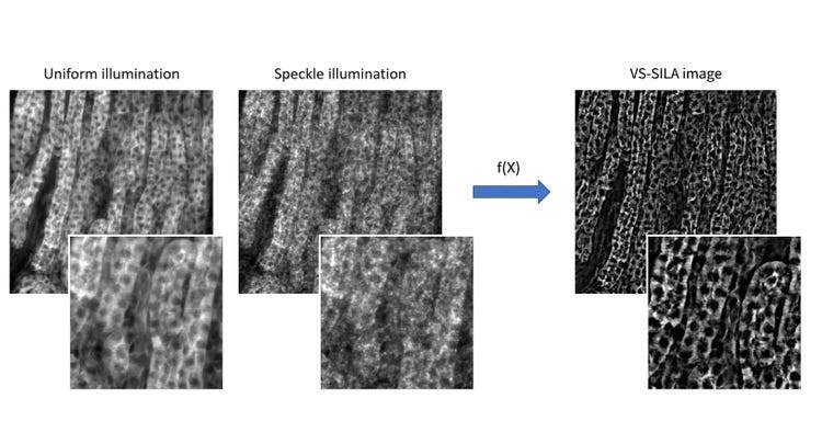 Un traitement rapide avec possibilité de visualiser les images optiquement sectionnées en temps réel