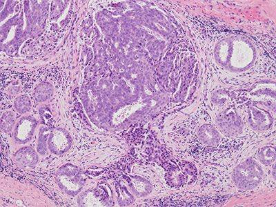 Live Super Resolutions Imaging