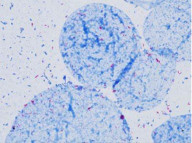 Tests effectués en laboratoire clinique