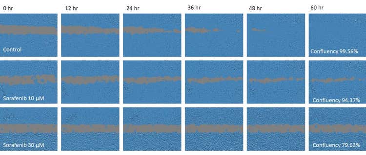 Automatisation de l’imagerie et de la quantification effectuées lors des essais de migration grâce à un système de surveillance de l’incubation