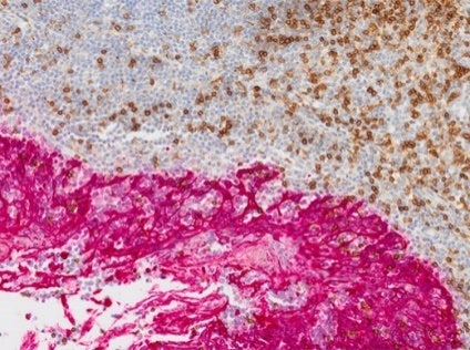 Ricerca sui tumori e le cellule staminali