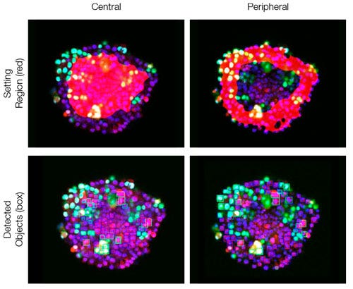 Figure 6. NoviSight software can classify both the central and peripheral parts