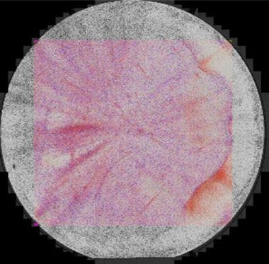 Wafer di SiC sottoposto a etching