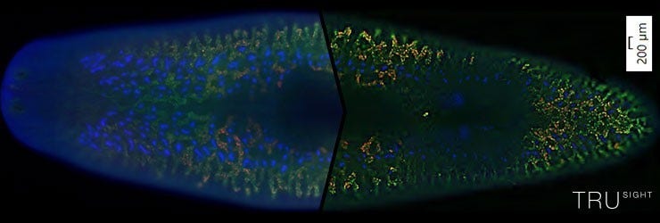 Funzionalità di eliminazione della sfocatura a fluorescenza in tempo reale
