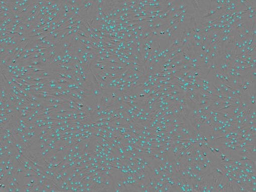 Cell count : 1.06 × 10³