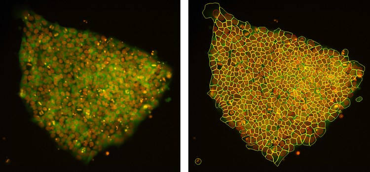 Pluripotent stem cells acquired and segmented with a scanR widefield microscope.