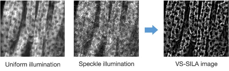 Figura 1. Sezione di rene murino a 20X. Il dispositivo VS-SILA sullo scanner VS200 combina un'illuminazione uniforme con un'illuminazione speckle, per fornire un'immagine combinata con un sezionamento ottico nitido.