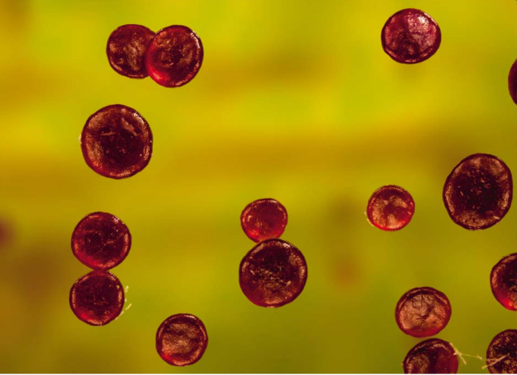 Peli di stelo di Sonchus asper; vista superiore dell'estremità dei peli Immagine acquisita da Gerd Günther.