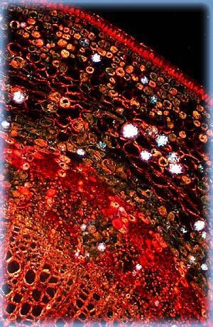 Immagine in campo oscuro di una sezione sottile di tiglio colorata