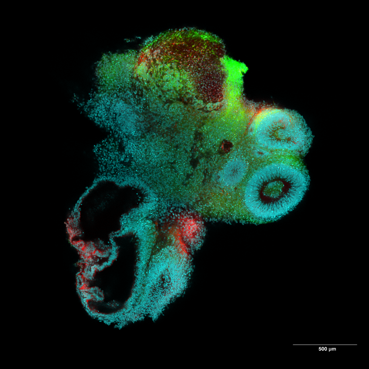 Organoide cerebrale al microscopio.