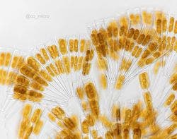 Licmophora diatom arrangement under the microscope