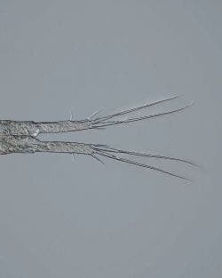Female copepod under the microscope
