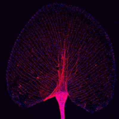 Fruit fly under the microscope